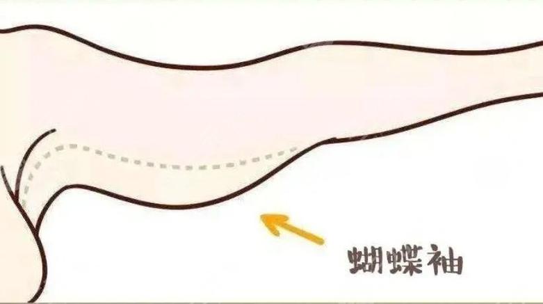 蝴蝶翅膀衣服-蝴蝶翅膀衣服图片-第3张图片